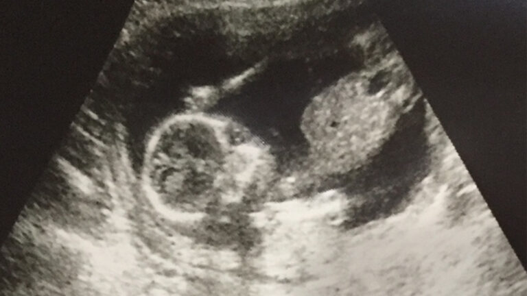 Pro-life groups to NM Supreme Court: No right to abortion in state constitution